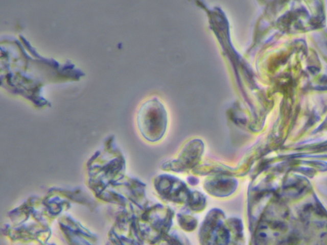 Botryobasidium con spore finemente verrucose